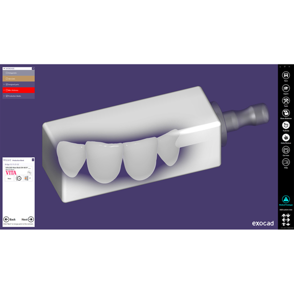 Exocad Modul In-CAD Nesting - фото 4