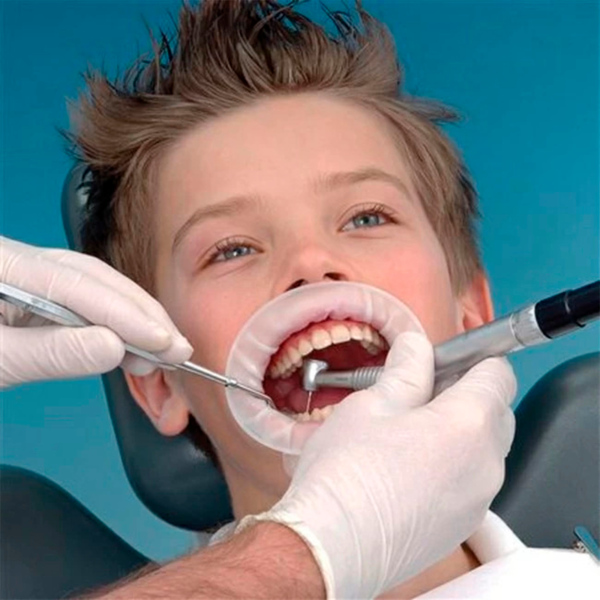 Ретрактор OptraGate, джуниор, 80 шт - фото 1