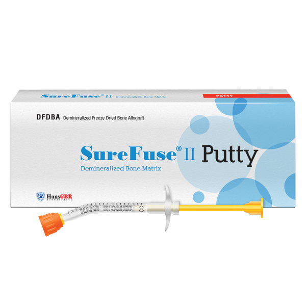 SureFuse II - деминерализированный костный матрикс, мастика, 0,3 см3 - фото 0