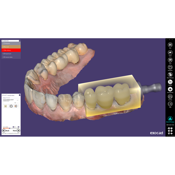 Exocad Modul In-CAD Nesting - фото 1