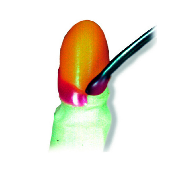 Воск для литья Cervical wax, под давлением, шейная область, прозр - фото 1