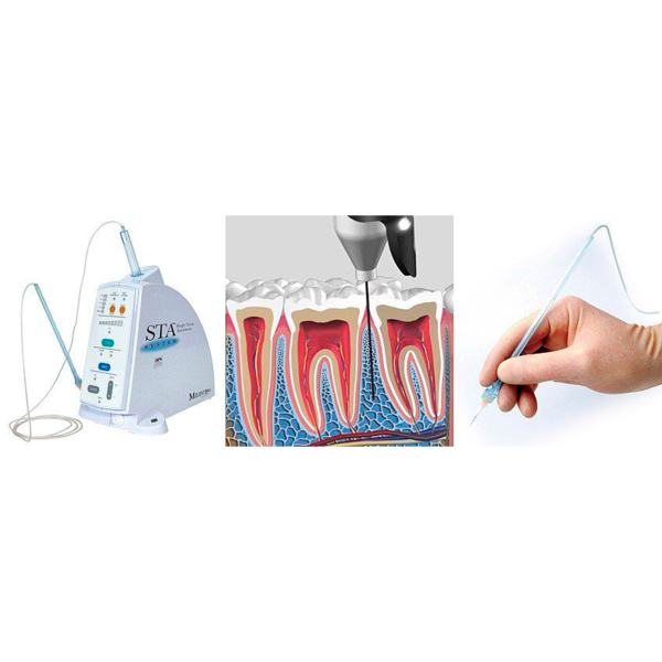 Компьютеризированная анестезия CompuDent STA - фото 7