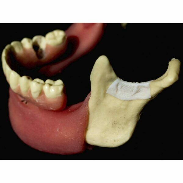 Мембрана коллагеновая Cardioplant bioPLATE Contur, резорбируемая, двухслойная, для костной и тканевой регенерации, 30х40 мм, 1 шт - фото 3