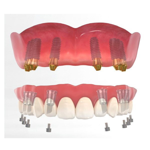 Multi Ti Base - титановые основания, высота 6.0, 5° - фото 2