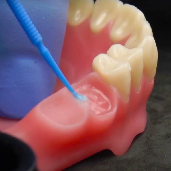 VITA VIONIC BOND KIT - самоотверждающаяся двухкомпонентная адгезионная система на основе ММА (VITA VIONIC BOND I - 2 мл, VITA VIONIC BOND II - 1 мл, Microbrush) - фото 4