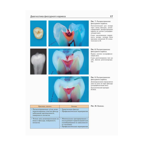 Эндодонтология, Бер Р., Бауманн М., Ким С. - фото 4
