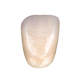 VITA MFT classical A1 – D4 - базовые фронтальные зубы из полимерного материала (цвет и форма на выбор), 1 гарнитур/6 зубов - фото 0