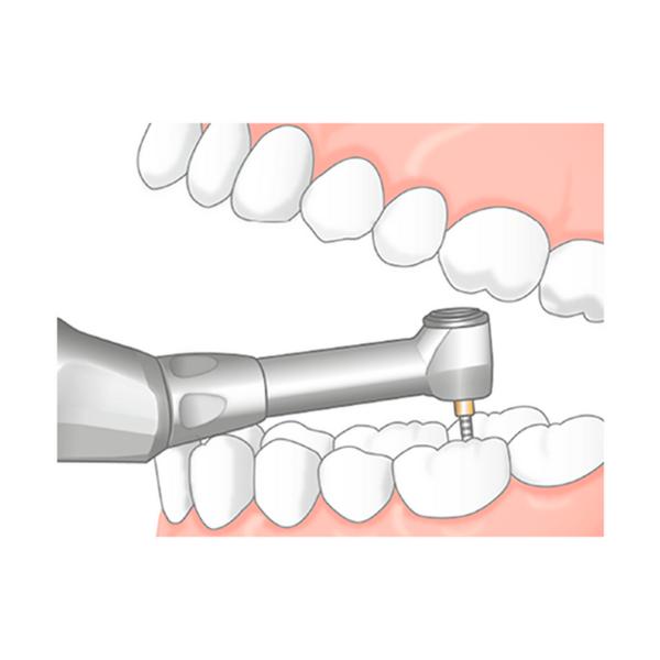 Endo-Mate TC2 MPA - беспроводной эндомотор с возможностью быстрого подключения апекслокатора - фото 7