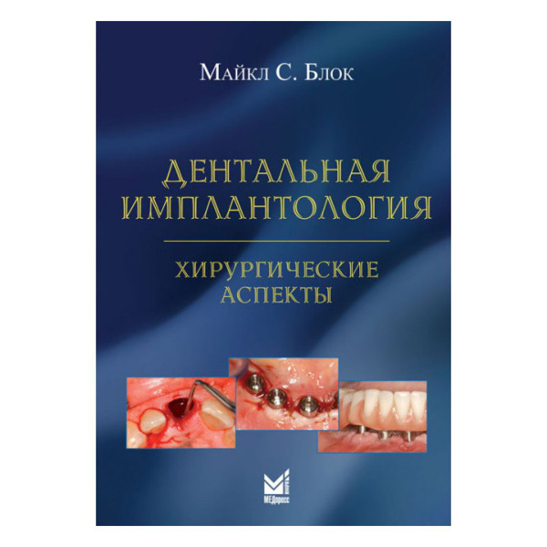 Дентальная имплантология: хирургические аспекты, Блок М. - фото 0