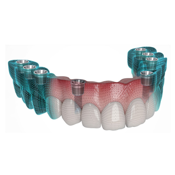 Multi Ti Base - титановые основания, высота 6.0, 5  - фото 3