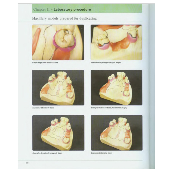 Precision milling and partial denture constructions, Henning Wulfes (английский язык) - фото 8