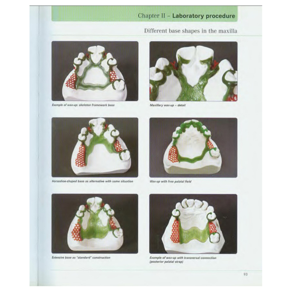 Precision milling and partial denture constructions, Henning Wulfes (английский язык) - фото 9