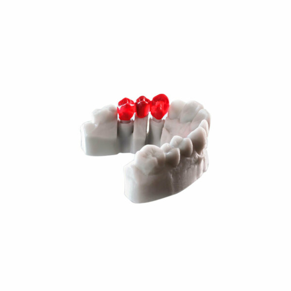 Фотополимерная смола Detax Freeprint cast, для литья каркасов бюгельных протезов, красная, 0.5 кг - фото 2