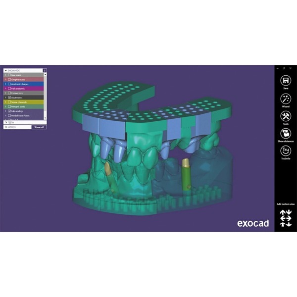 Обновления программного обеспечения для Exocad, модуль создания моделей - фото 0