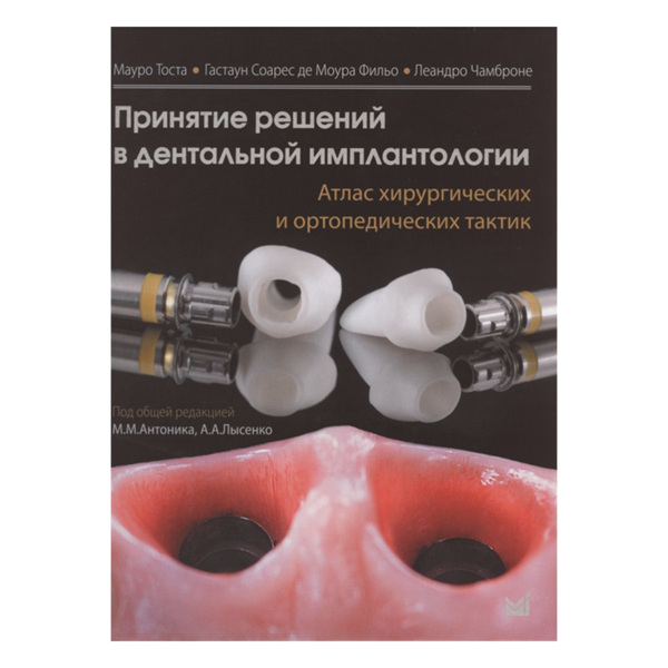 Принятие решений в дентальной имплантологии. Атлас хирургических и ортопедических тактик, Тоста М. - фото 0