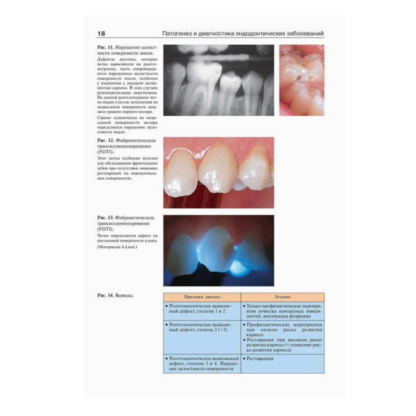 Эндодонтология, Бер Р., Бауманн М., Ким С. - фото 5