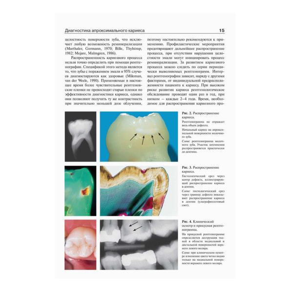 Эндодонтология, Бер Р., Бауманн М., Ким С. - фото 2