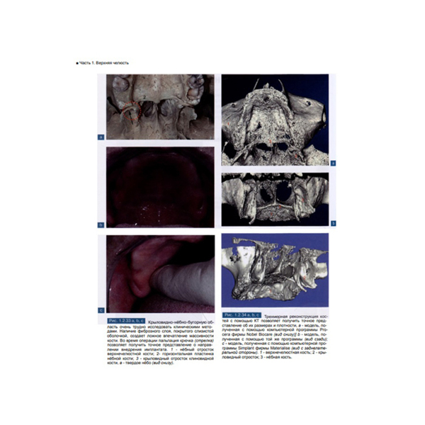 Атлас анатомии зубочелюстной системы для имплантологов, Годи Ж.-Ф. - фото 5