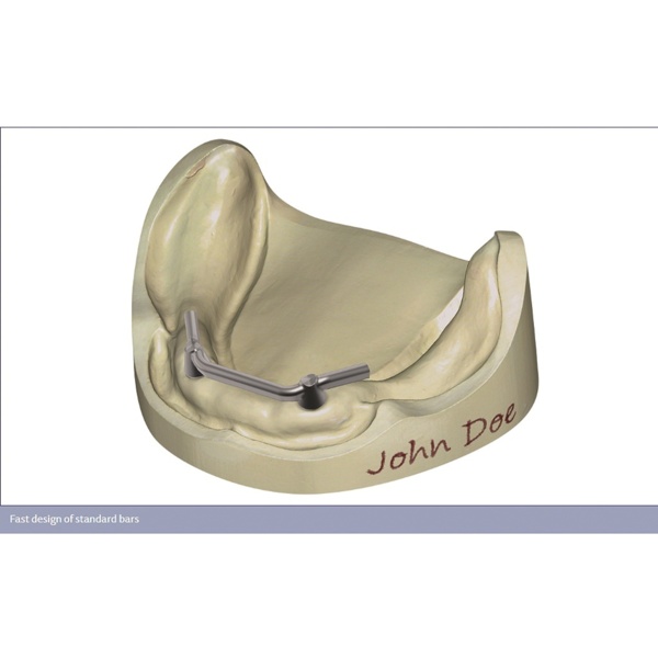 Обновления программного обеспечения для Exocad, модуль балок - фото 3