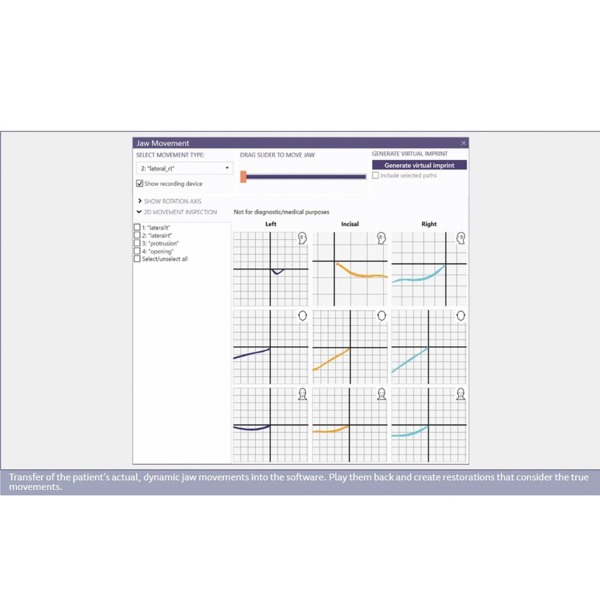 Обновления программного обеспечения для Exocad, Zebris/Jaw Motion Import - фото 2