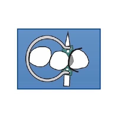 Кольцо «Дельта» №1.299 - фото 2