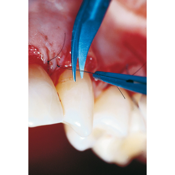 Ножницы Castroviejo, микрохирургические, изогнутые, 18 см, титановая ручка - фото 1