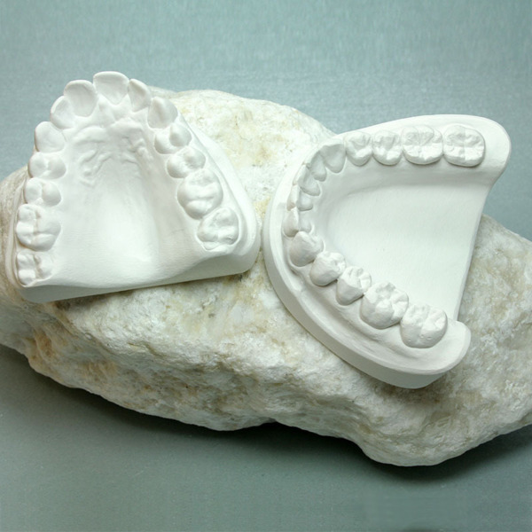 Алебастровый гипс, тип 2, натурально-белый, коробка 20 кг - фото 0