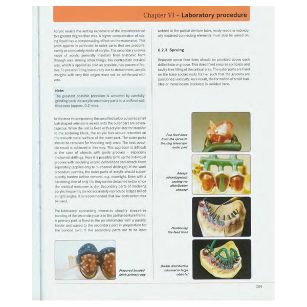 Precision milling and partial denture constructions, Henning Wulfes (английский язык) - фото 2