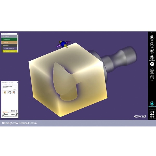 Обновления программного обеспечения для Exocad, модуль nesting (включая In-CAD Nesting) - фото 2