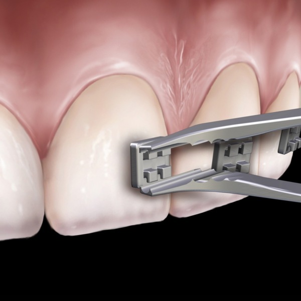 Пинцет ортодонтический Hu-Friedy 678-504, обратный, тонкий профиль, изогнутый, для установки брекетов - фото 3