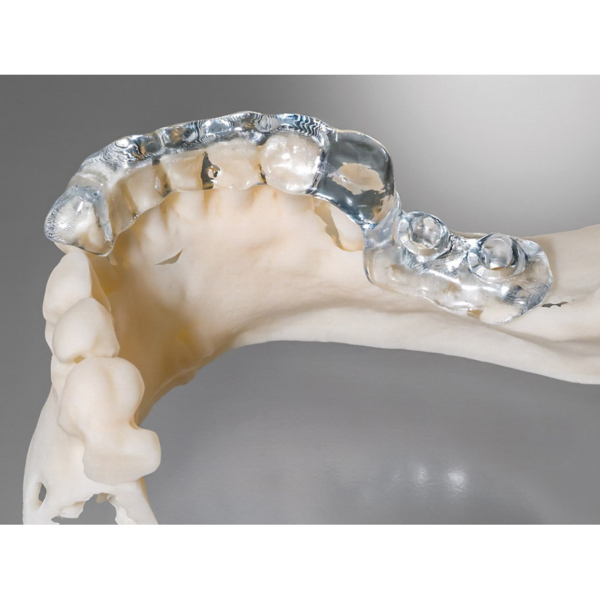 Фотополимерная смола Detax Freeprint ortho 405, для 3D-печати изготовления ортодонтических баз и капп, 1 кг - фото 7