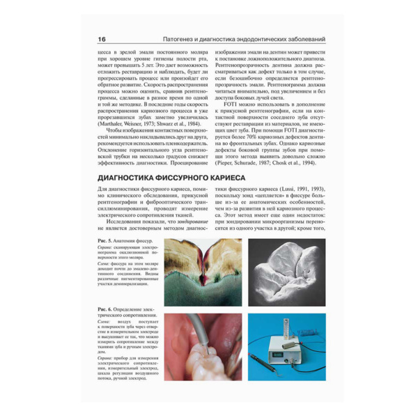 Эндодонтология, Бер Р., Бауманн М., Ким С. - фото 3