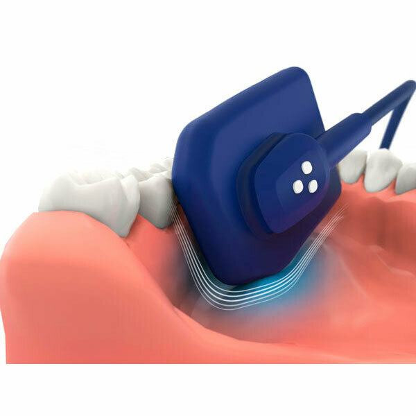 Радиовизиограф EzSensor Soft - фото 5