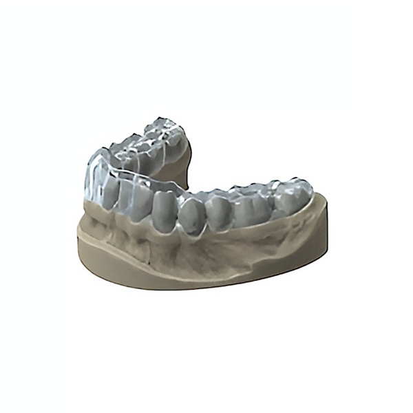 Обновления программного обеспечения для Exocad, модуль окклюзионной шины - фото 1