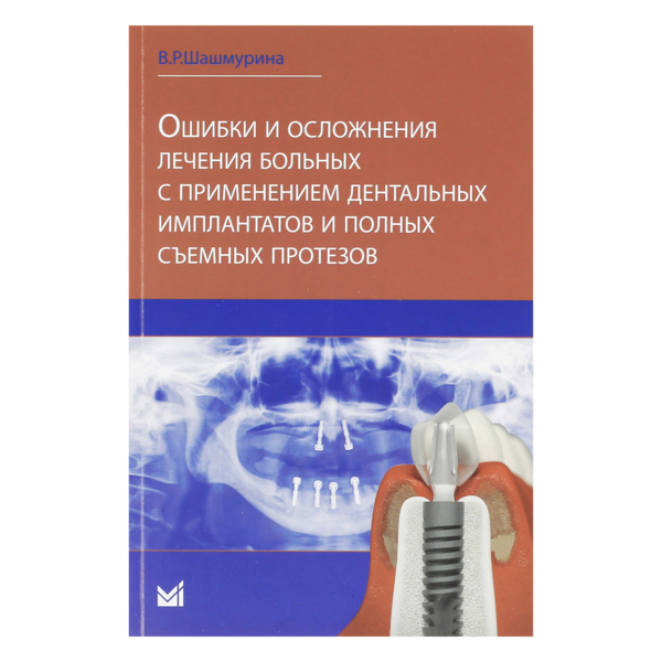 Ошибки и осложнения лечения больных с применением дентальных имплантатов и полных съемных протезов, Шашмурина В.Р. - фото 0