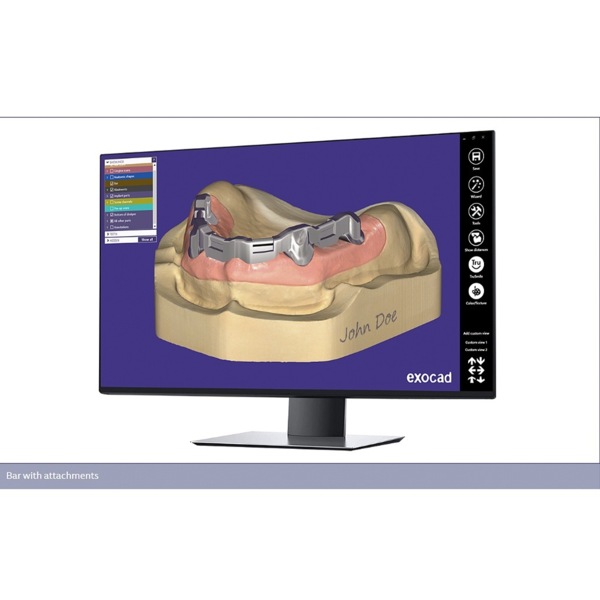 Обновления программного обеспечения для Exocad, модуль - фото 4