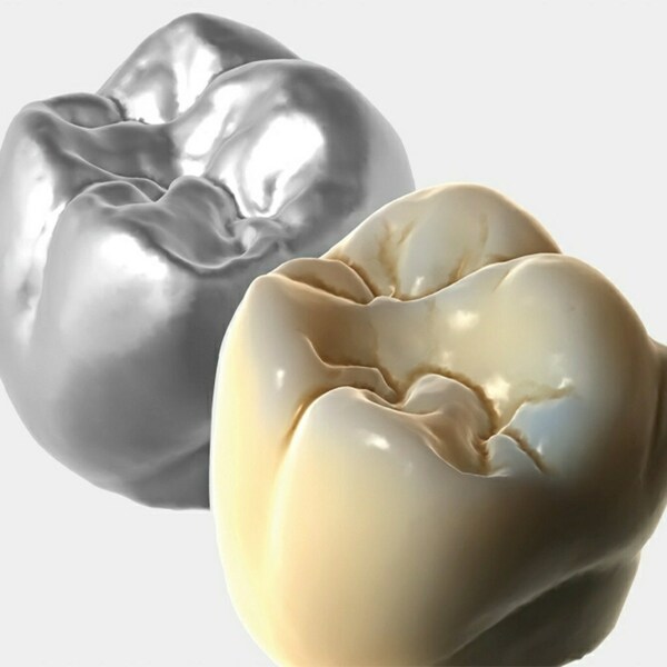 Обновления программного обеспечения для Exocad, модуль TruSmile - фото 1