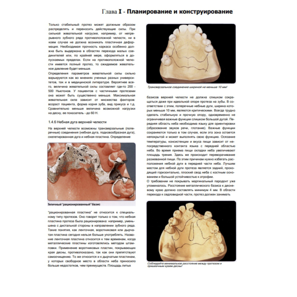 Современные технологии протезирования, Хэннинг Вульфес - фото 9