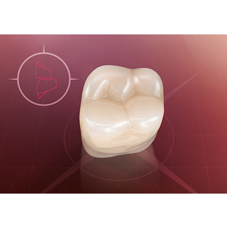 Зубы VITAPAN CUSPIFORM classical A1 – D4, жевательные (цвет и форма на выбор), 1 шт - фото 1