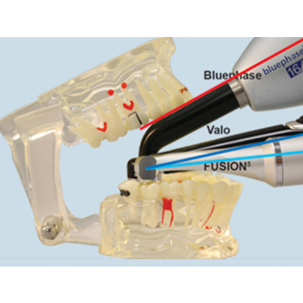 FUSION 5 CURING LIGHT Kit - лампа стоматологическая светодиодная полимеризационная - фото 7