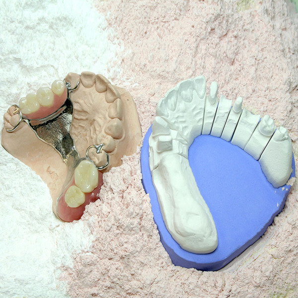 Neo Stone, pink, 4 x 5 kg paper bag - супер прочный гипс, 4 тип, синтетический, розовый, 4 х 5 кг бумажный мешок - фото 0