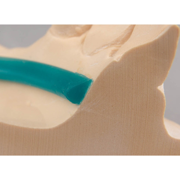 Восковые бюгеля Geo, для нижней челюсти - фото 1