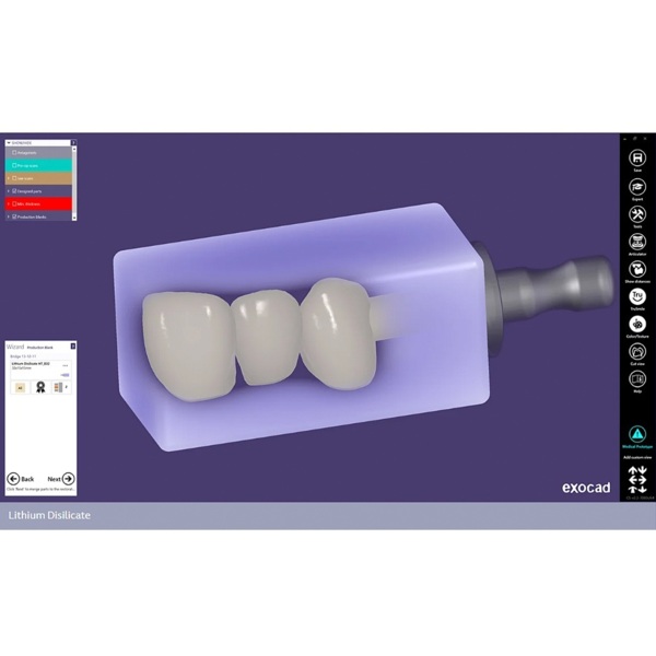 Обновления программного обеспечения для Exocad, модуль nesting (включая In-CAD Nesting) - фото 1