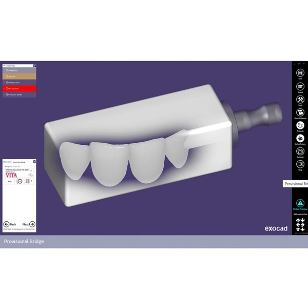 Обновления программного обеспечения для Exocad, модуль nesting (включая In-CAD Nesting) - фото 3