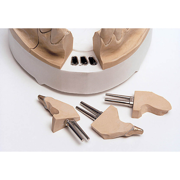 Штифты Renfert Bi-V-Pin с пластиковой втулкой, 1000 шт - фото 1