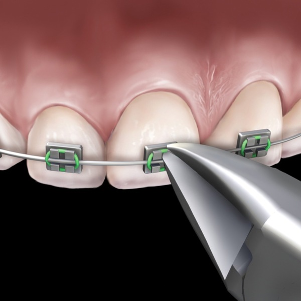 Кусачки для лигатурной проволоки, Slim Collection, под углом 15  - фото 3
