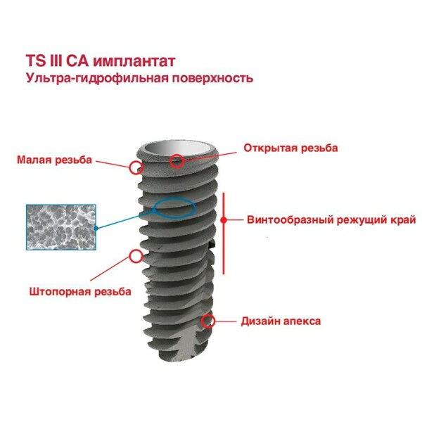 Имплантат OSSTEM TS III CA Standart, в кальциевом растворе, D=4.0 мм, L=15.0 мм, с адаптером и винт-заглушкой D=1.2 мм - фото 1