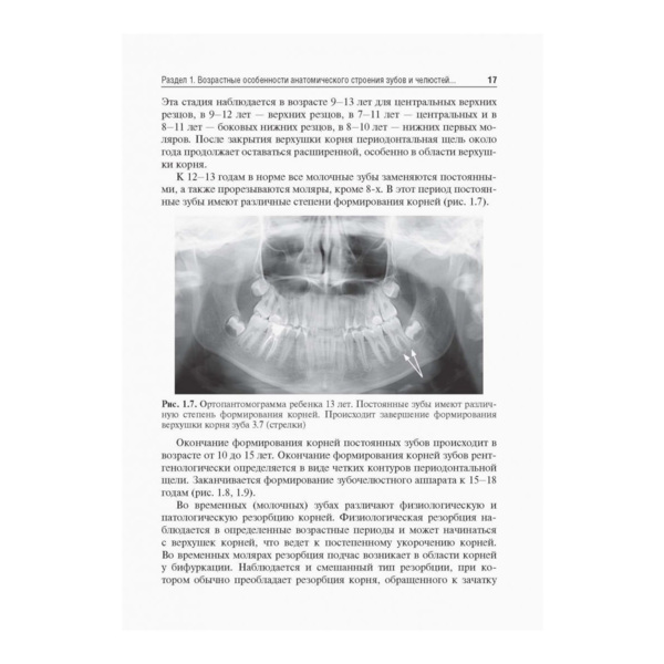 Рентгеноанатомия и рентгенодиагностика в стоматологии, В. П. Трутень - фото 4