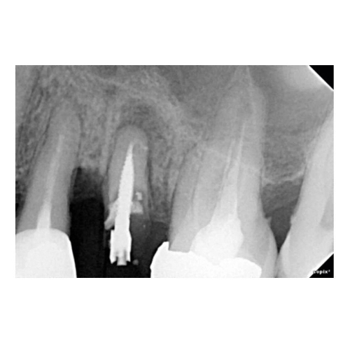 SOPIX 2 USB - датчик, размер 2, стандартный (под Mac) - фото 3