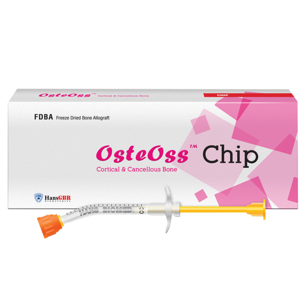 Крошка кортикально-губчатая OSSTEM OsteOss, резорбируемая, для костных дефектов, 1 мл, шприц, 1 шт - фото 0